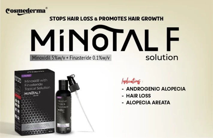 Best PCD Pharma Franchise For Minoxidil 10% & Finasteride 0.1% Lotion 1