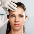 INJECTIONS 1