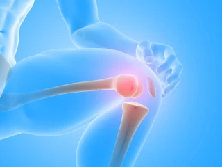 orthopaedic products suppliers