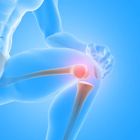 Best Orthopaedic Products Suppliers Across India 1