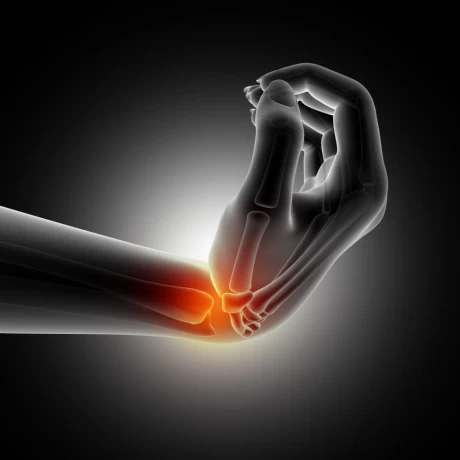 Leading Ortho Products Franchise Company India 1