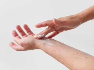 antifungal cream product manufacturers