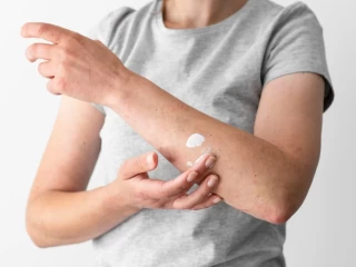 antifungal cream product company