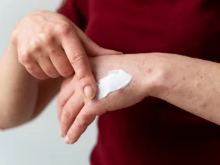 Best Antifungal Cream Franchise Company in India