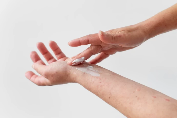 Premier Antifungal Ointments Supplier in India 1