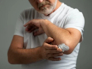 antifungal cream franchise companies